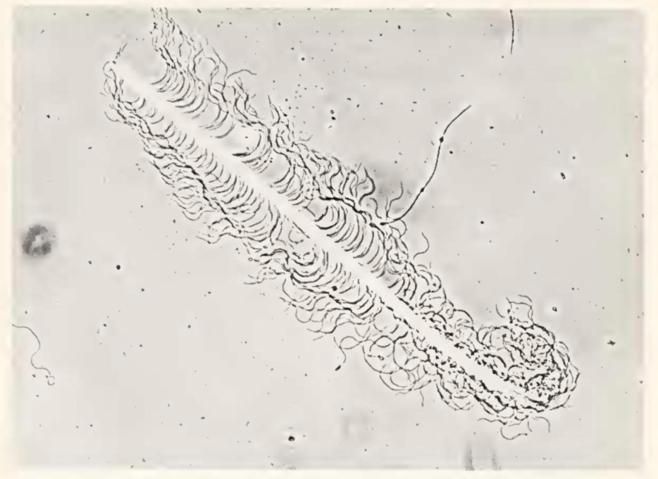 beetle-sperm
